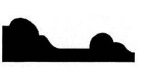 Silhouette of a profile with a large bump on the left and a smaller bump on the right against a white background.